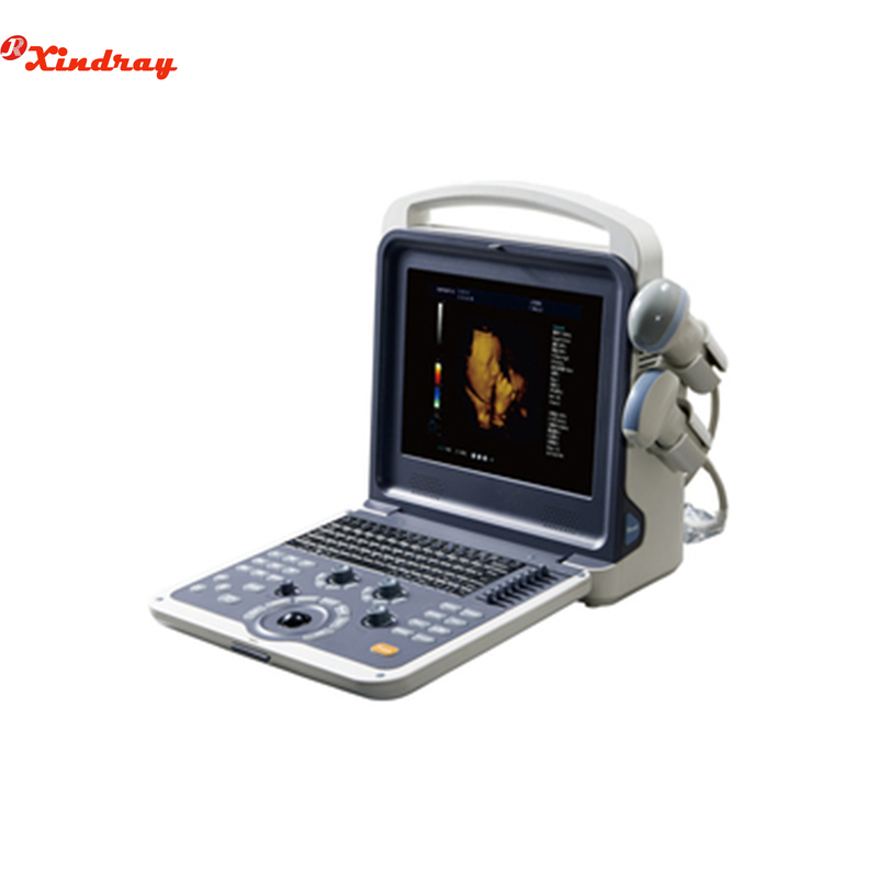 Sistema de diagnóstico ultrasónico Doppler a color completamente digital