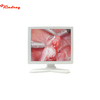 Monitor para endoscopio