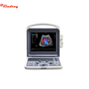 Sistema portátil de diagnóstico por ultrasonido Doppler color