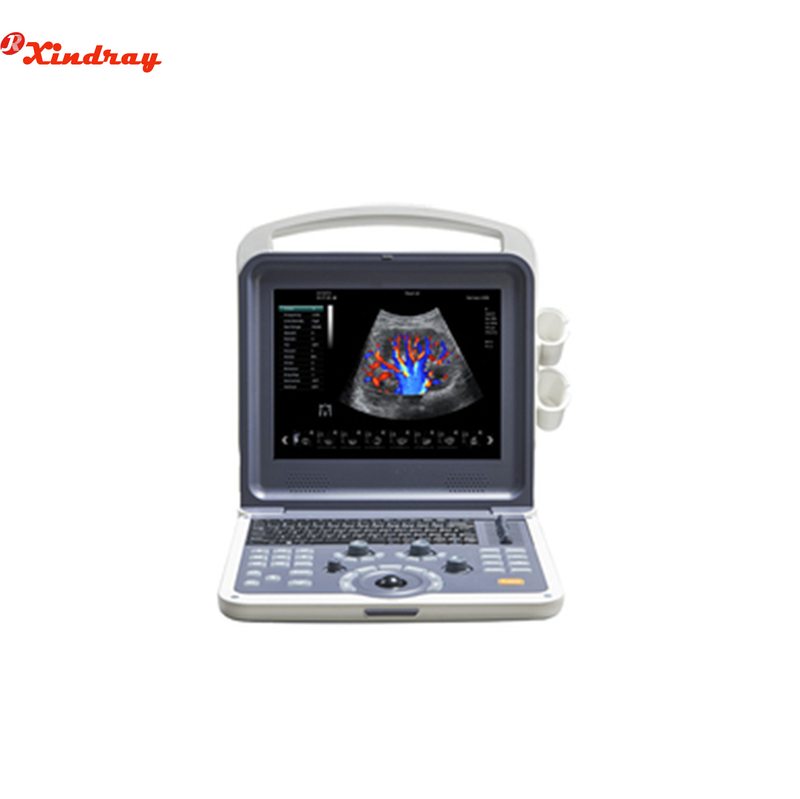 Sistema portátil de diagnóstico por ultrasonido Doppler color
