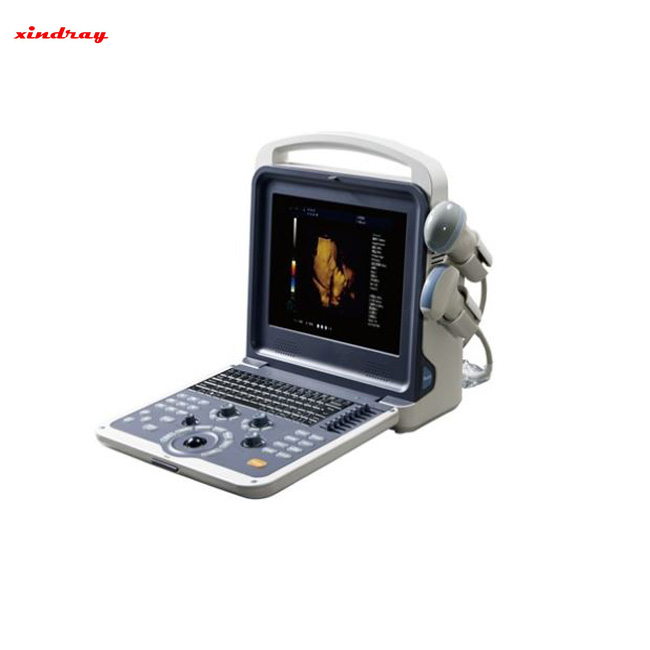 Ultrasonido Doppler de color portátil