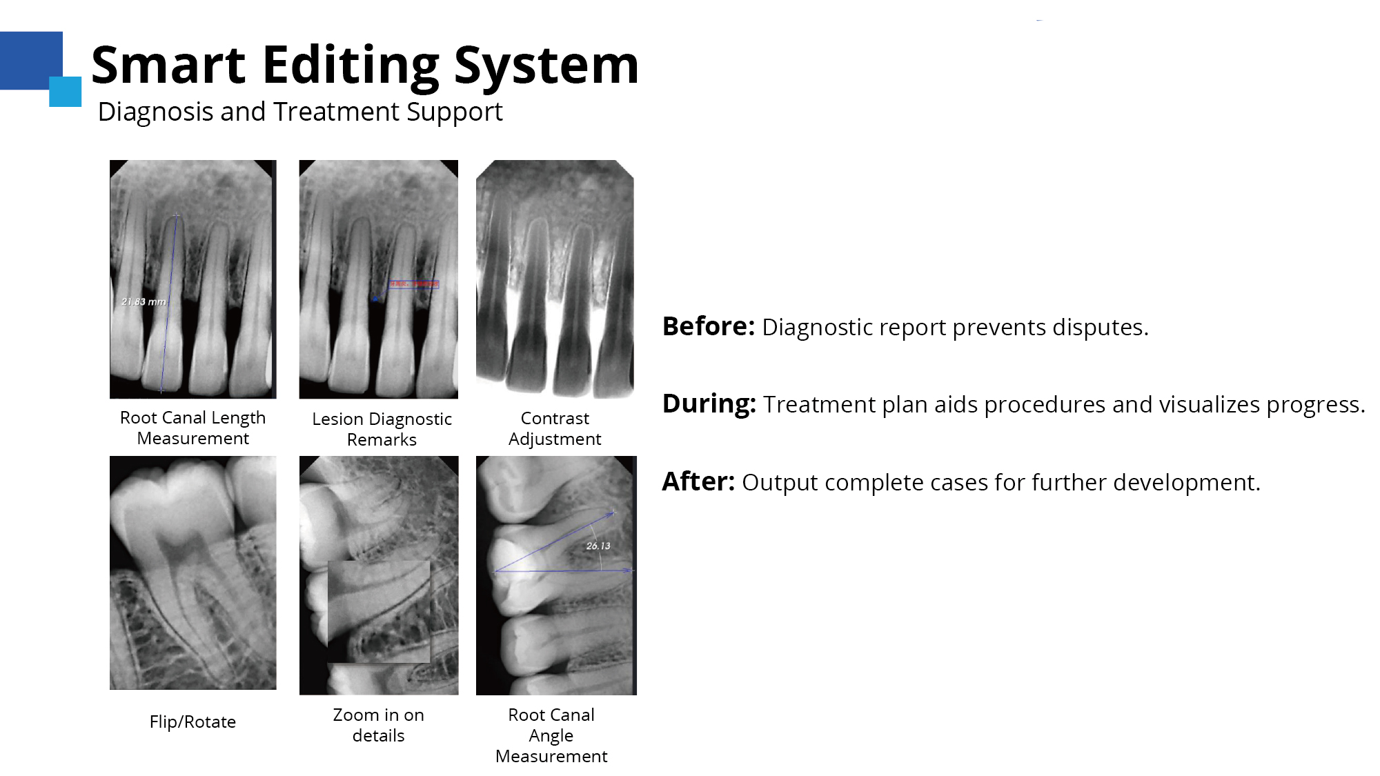 imagen de radiograf&iacute;a dental1